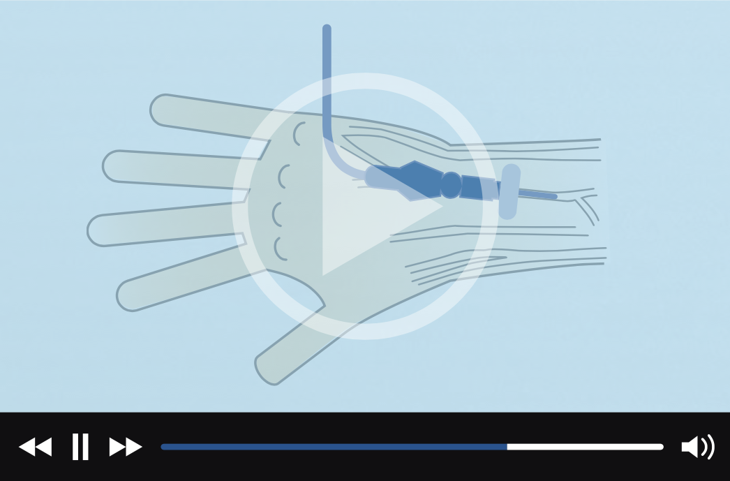 Video Thumbnail - Peripheral IV